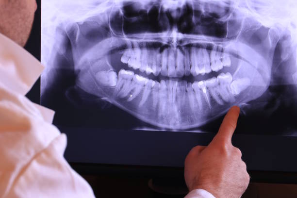 Best Emergency TMJ Treatment in Hoover, AL